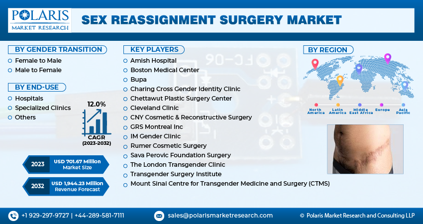 Sex Reassignment Surgery Market Size